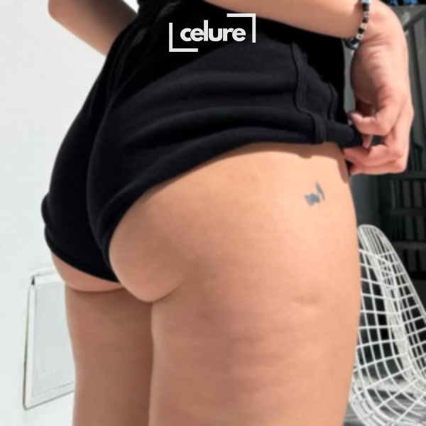 dd